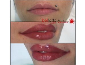 tatuaggio-labbra-napoli